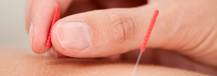 Acupuncture in Bremerton WA