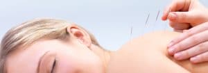 Acupuncture in Bremerton WA