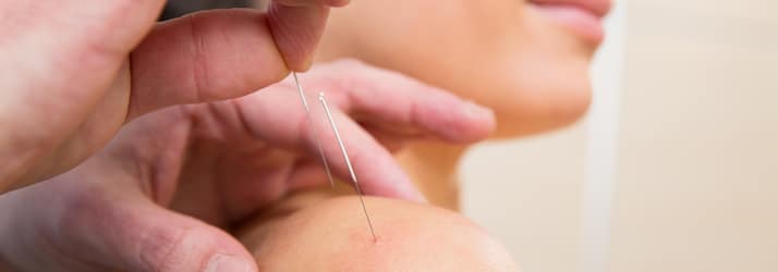 Acupuncture in Bremerton WA